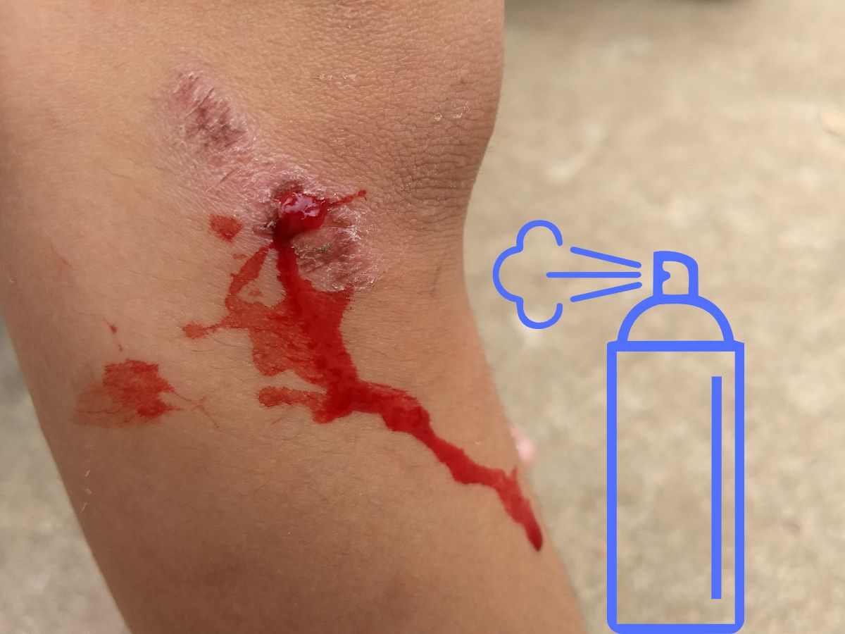 Spray contro emorragie